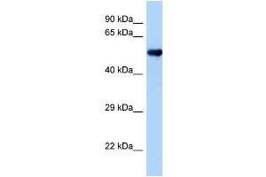 WB Suggested Anti-Oxsr1 Antibody   Titration: 1. (OXSR1 anticorps  (Middle Region))