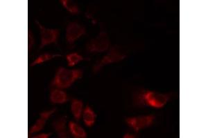 ABIN6268852 staining HeLa by IF/ICC. (GORASP2 anticorps  (Internal Region))