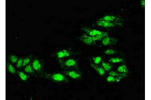 anti-Excision Repair Cross-Complementing Rodent Repair Deficiency, Complementation Group 4 (ERCC4) (AA 656-753) antibody