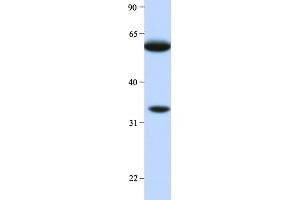 Host:  Rabbit  Target Name:  HRG  Sample Type:  Human Liver  Antibody Dilution:  1.