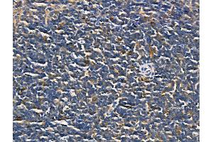 ABIN6260641 and ABIN6268823 at 1/100 staining Mouse spleen tissue by IHC-P. (CD69 anticorps  (Internal Region))