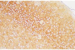 Immunohistochemistry of paraffin-embedded Mouse brain using TGFBR1 Polycloanl Antibody at dilution of 1:200 (TGFBR1 anticorps)