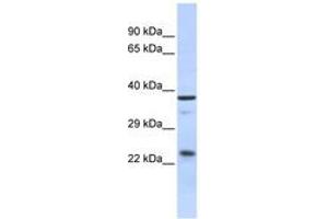 Image no. 1 for anti-SERTA Domain Containing 1 (SERTAD1) (AA 35-84) antibody (ABIN6742458) (SERTAD1 anticorps  (AA 35-84))