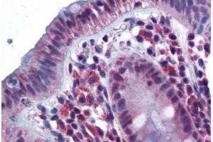 Human Colon (formalin-fixed, paraffin-embedded) stained with CD180 antibody ABIN343899 at 5 ug/ml followed by biotinylated goat anti-rabbit IgG secondary antibody ABIN481713, alkaline phosphatase-streptavidin and chromogen. (CD180 anticorps  (N-Term))