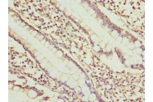 Immunohistochemistry of paraffin-embedded human small intestine tissue using ABIN7149657 at dilution of 1:100