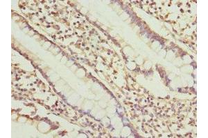 Immunohistochemistry of paraffin-embedded human small intestine tissue using ABIN7149657 at dilution of 1:100 (SGCD anticorps  (AA 60-289))