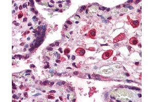 Immunohistochemistry (IHC) image for anti-Eomesodermin (EOMES) (C-Term) antibody (ABIN2779928)