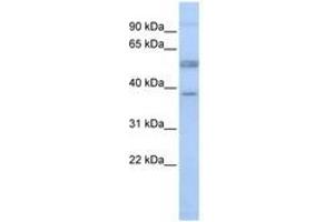 Image no. 1 for anti-Lymphocyte-Specific Protein 1 (LSP1) (AA 36-85) antibody (ABIN6741485) (LSP1 anticorps  (AA 36-85))