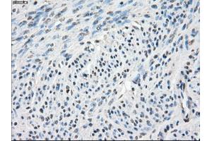Immunohistochemistry (IHC) image for anti-Carbonic Anhydrase IX (CA9) antibody (ABIN1497095) (CA9 anticorps)