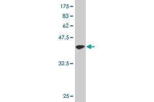 Western Blot detection against Immunogen (35. (CDK4 anticorps  (AA 211-303))
