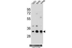 TPM4 Antibody (N-term) western blot analysis in U251,A549,Jurkat cell line lysates (35 µg/lane). (Tropomyosin 4 anticorps  (N-Term))