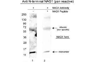 Image no. 1 for anti-Growth Differentiation Factor 15 (GDF15) (N-Term), (Variant D), (Variant H) antibody (ABIN453967) (GDF15 anticorps  (N-Term, Variant D, Variant H))