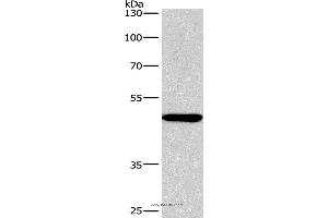 Western blot analysis of A549 cell, using BMP15 Polyclonal Antibody at dilution of 1:266. (BMP15 anticorps)