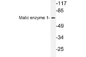 Western blot (WB) analysis of Malic enzyme 1 antibody in extracts from HeLa cells. (ME1 anticorps)