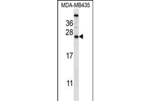 CABP5 Antibody (N-term) (ABIN657414 and ABIN2846452) western blot analysis in MDA-M cell line lysates (35 μg/lane). (CABP5 anticorps  (N-Term))