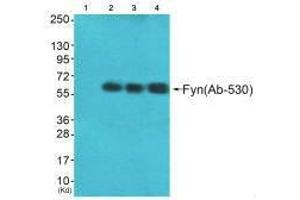 Western blot analysis of extracts from HeLa cells (Lane 2), A549 cells (Lane 3) and HepG2 cells (Lane 4), using Fyn (Ab-530) antiobdy. (FYN anticorps  (Tyr530))