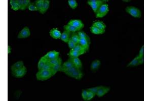 Immunofluorescence staining of HepG2 cells with ABIN7160580 at 1:100, counter-stained with DAPI.