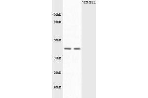 L1 Mouse intestine lysate L2 mouse liver lysates probed with Rabbit Anti-LAMP2/CD107B Polyclonal Antibody, Unconjugated  at 1:3000 for 90 min at 37˚C.