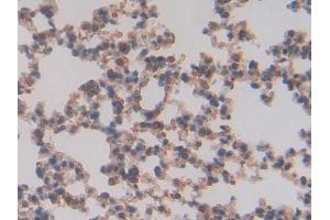 Detection of TFAM in Mouse Lung Tissue using Polyclonal Antibody to Transcription Factor A, Mitochondrial (TFAM)