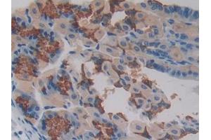 DAB staining on IHC-P; Samples: Mouse Stomach Tissue