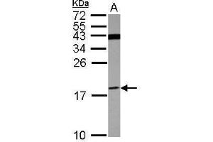 WB Image Sample (30 ug of whole cell lysate) A: U87-MG 15% SDS PAGE antibody diluted at 1:500 (ATP6V1F anticorps)