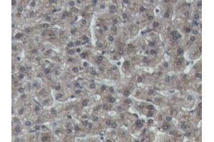 DAB staining on IHC-P; Samples: Porcine Liver Tissue