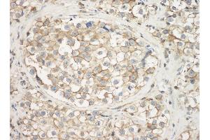 Immunohistochemistry (IHC) image for anti-Cytoskeletal Actin (CIMG_00972) (N-Term) antibody (ABIN7453904) (Cytoskeletal Actin (CIMG_00972) (N-Term) anticorps)
