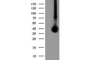Western Blotting (WB) image for anti-Family with Sequence Similarity 84, Member B (FAM84B) antibody (ABIN1498208) (FAM84B anticorps)