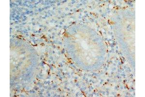 Anti-IL-8 antibody, IHC(P) IHC(P): Human Appendicitis Tissue (IL-8 anticorps  (C-Term))