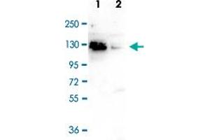 Western Blot (Cell lysate) analysis of (1) Negative control, and (2) 40 ug whole cell extracts of HeLa cells transfected with CTCF siRNA. (CTCF anticorps)
