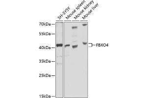 Western blot analysis of extracts of various cell lines, using FBXO4 antibody (ABIN6130382, ABIN6140525, ABIN6140526 and ABIN6225310) at 1:1000 dilution. (FBXO4 anticorps  (AA 138-387))
