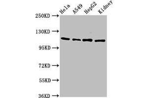Western Blot Positive WB detected in: Hela whole cell lysate, A549 whole cell lysate, HepG2 whole cell lysate, Rat kidney tissue All lanes: NFATC3 antibody at 4.