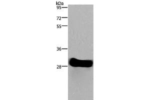 Western Blot analysis of Mouse heart tissue using FHL2 Polyclonal Antibody at dilution of 1:1900 (FHL2 anticorps)