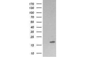 Image no. 2 for anti-Cancer/testis Antigen 1B (CTAG1B) antibody (ABIN1499894)