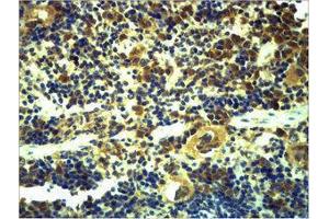 Immunohistochemistry (IHC) image for anti-Toll-Like Receptor 6 (TLR6) antibody (ABIN3179058) (TLR6 anticorps)