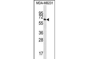 GBP1 Antibody (N-term) (ABIN656423 and ABIN2845715) western blot analysis in MDA-M cell line lysates (35 μg/lane). (GBP1 anticorps  (N-Term))