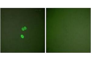 Immunofluorescence analysis of NIH-3T3 cells, using Galectin 3 Antibody. (Galectin 3 anticorps  (AA 141-190))