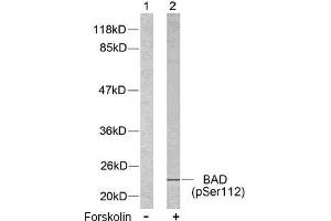 Image no. 2 for anti-BCL2-Associated Agonist of Cell Death (BAD) (pSer112), (pSer75) antibody (ABIN196734) (BAD anticorps  (pSer75, pSer112))