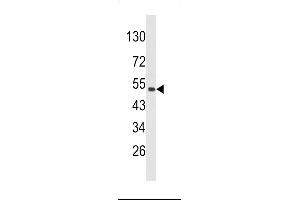 Western blot analysis of CKIP-1 Antibody (N-term) (ABIN652439 and ABIN2842298) in 293 cell line lysates (35 μg/lane).