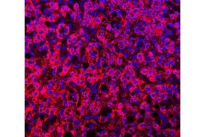 IF analysis of TTLL2 using anti-TTLL2 antibody (ABIN7600850).