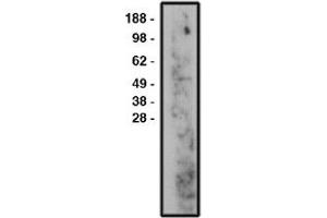 Image no. 1 for anti-Sphingomyelin Phosphodiesterase 3 (SMPD3) antibody (ABIN265269) (SMPD3 anticorps)
