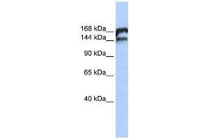 TOP2B antibody used at 0. (TOP2B anticorps  (Middle Region))