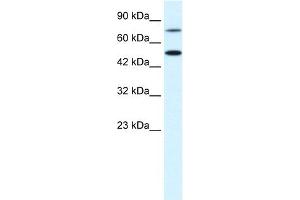 WB Suggested Anti-CHML Antibody Titration:  0. (CHML anticorps  (N-Term))