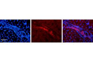 KRT8 antibody - middle region          Formalin Fixed Paraffin Embedded Tissue:  Human Liver Tissue    Observed Staining:  Cytoplasm and membrane in epithelial cells of hepatic ducts   Primary Antibody Concentration:  1:100    Secondary Antibody:  Donkey anti-Rabbit-Cy3    Secondary Antibody Concentration:  1:200    Magnification:  20X    Exposure Time:  0.