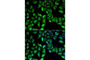 Immunofluorescence analysis of A549 cells using GDA antibody. (GDA anticorps  (AA 165-454))