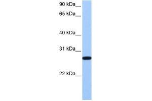 ECT2 antibody used at 1 ug/ml to detect target protein. (ECT2 anticorps  (Middle Region))