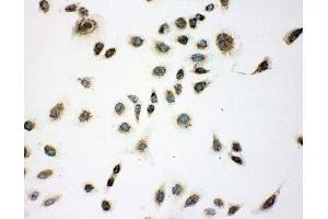 ICC: A549 cells (CACYBP anticorps  (Middle Region))