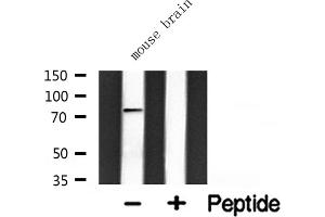 Western blot analysis of extracts from mouse brain, using GIT2 antibody.