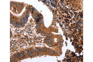Immunohistochemistry (IHC) image for anti-C-Type Lectin Domain Family 4, Member A (CLEC4A) antibody (ABIN1871908) (CLEC4A anticorps)