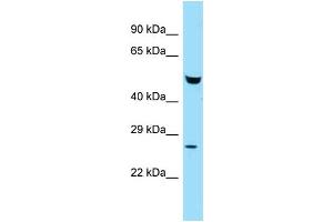 WB Suggested Anti-Faf2 Antibody Titration: 1. (FAF2 anticorps  (N-Term))